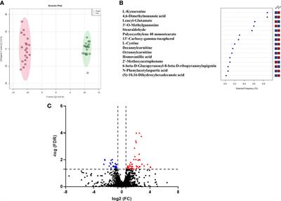 The metabolomics approach revealed a distinctive metabolomics pattern associated with hyperthyroidism treatment